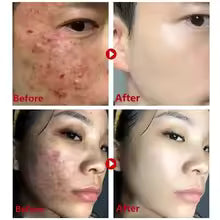 Cleansing Green Tea Mask Clay Stick Oil Control Anti-Acne Whitening Seaweed Mask Skin Care